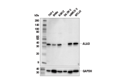Western Blotting Image 2: ALAD (E8Z7Y) Rabbit mAb
