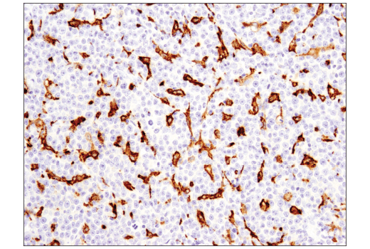 Immunohistochemistry Image 3: CD163 (D6U1J) Rabbit mAb