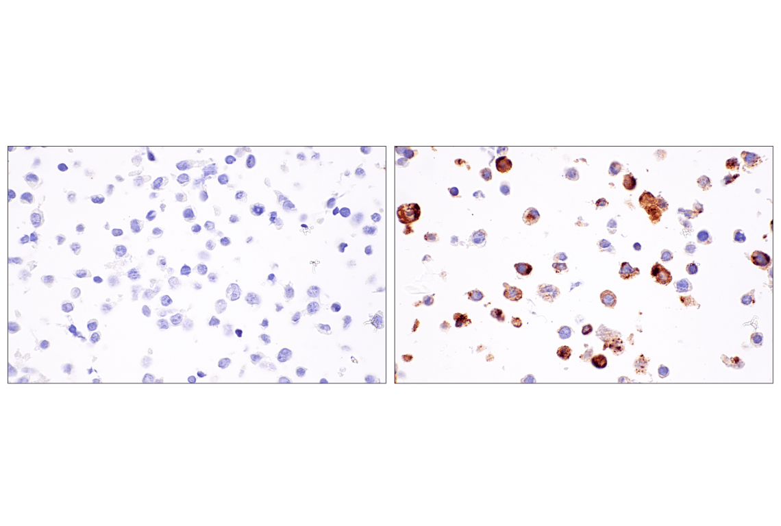 Immunohistochemistry Image 6: IL-8 (E5F5Q) XP<sup>®</sup> Rabbit mAb (BSA and Azide Free)