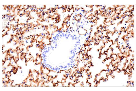 Immunohistochemistry Image 8: CD38 (E9F5A) XP<sup>®</sup> Rabbit mAb