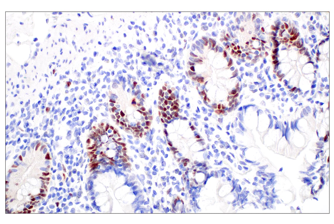 Immunohistochemistry Image 8: BRCA1 (E5S9G) Rabbit mAb