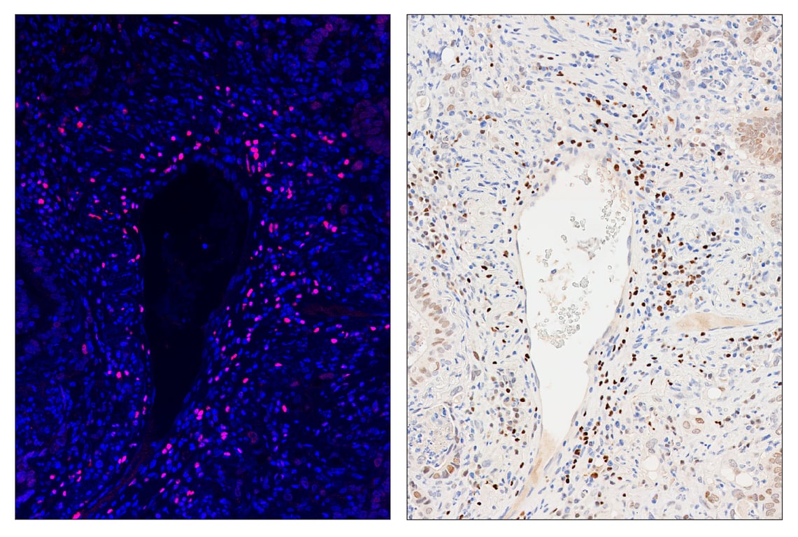 Immunohistochemistry Image 6: TCF1/TCF7 (C63D9) & CO-0006-594 SignalStar<sup>™</sup> Oligo-Antibody Pair