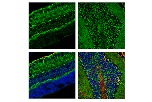 Immunofluorescence Image 1: AQP4 (D1F8E) XP<sup>®</sup> Rabbit mAb