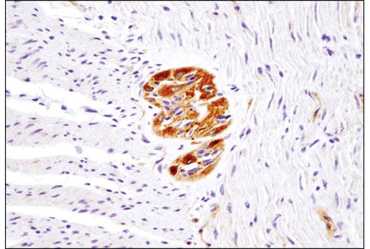 Immunohistochemistry Image 3: Ret (E1N8X) XP<sup>®</sup> Rabbit mAb (BSA and Azide Free)