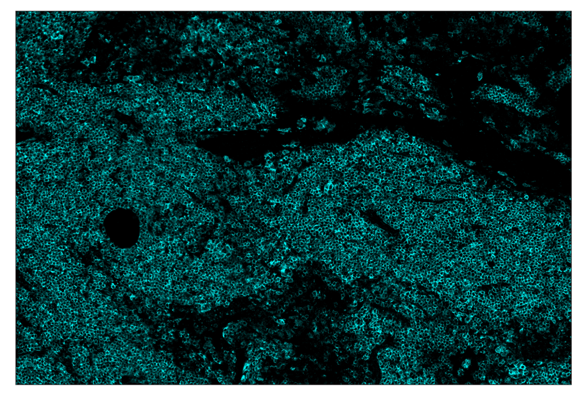 Immunohistochemistry Image 4: CD19 (Intracellular Domain) (D4V4B) & CO-0054-488 SignalStar<sup>™</sup> Oligo-Antibody Pair