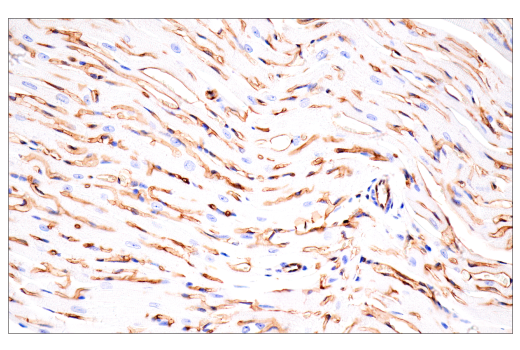Immunohistochemistry Image 12: CD38 (E9F5A) XP<sup>®</sup> Rabbit mAb