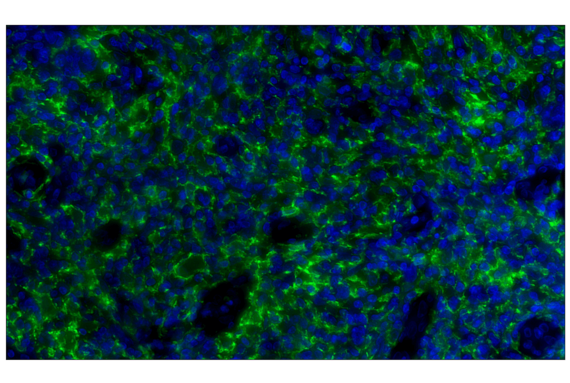 Immunohistochemistry Image 2: Iba1/AIF-1 (E4O4W) XP<sup>®</sup> Rabbit mAb (Alexa Fluor<sup>®</sup> 488 Conjugate)