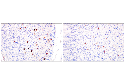 Immunohistochemistry Image 7: CD177 (E1V7N) Rabbit mAb (BSA and Azide Free)