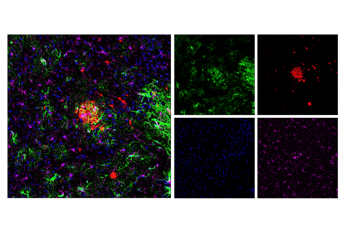 Immunofluorescence Image 1: GFAP (E6N9L) Mouse mAb