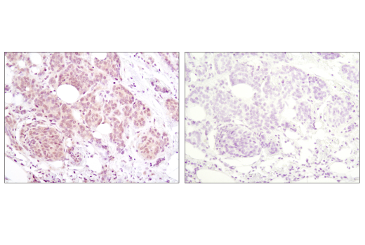 Immunohistochemistry Image 1: Akt (pan) (40D4) Mouse mAb (BSA and Azide Free)