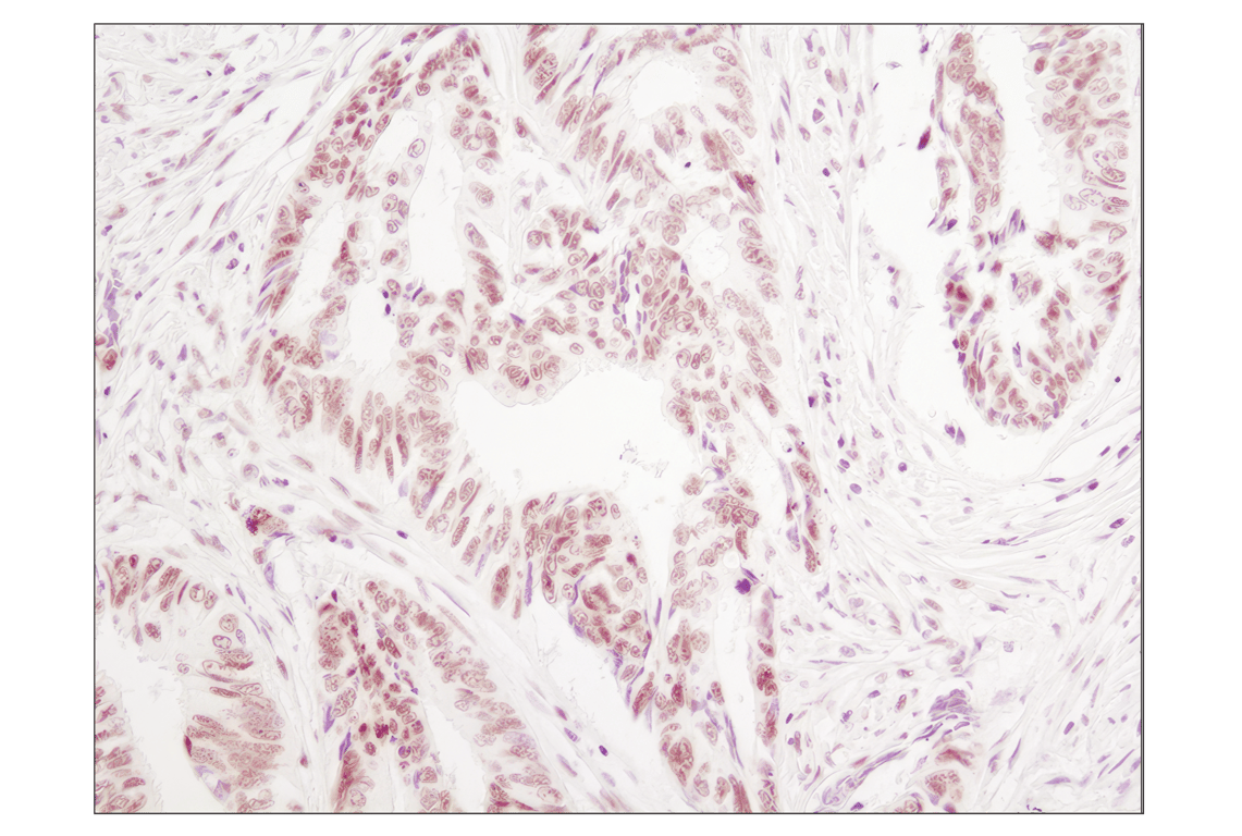 undefined Image 3: PhosphoPlus<sup>®</sup> p38 MAPK (Thr180/Tyr182) Antibody Duet