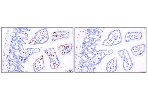 Immunohistochemistry Image 4: CD3ε (E4T1B) XP<sup>®</sup> Rabbit mAb (BSA and Azide Free)
