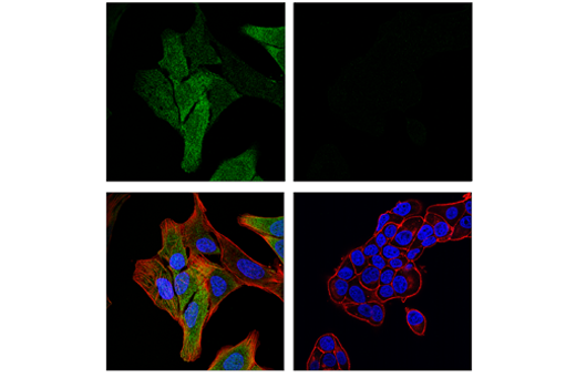 Immunofluorescence Image 1: MAGE-A4 (E7O1U) XP<sup>®</sup> Rabbit mAb