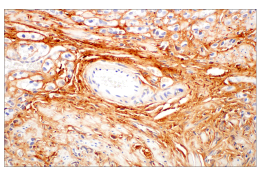Immunohistochemistry Image 1: COL14A1 (E5W8S) Rabbit mAb (BSA and Azide Free)
