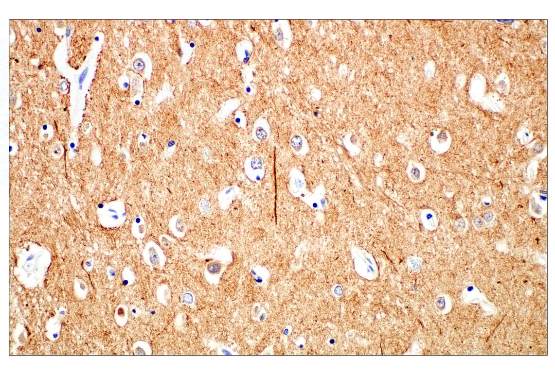 Immunohistochemistry Image 1: β3-Tubulin (E9F3E) Mouse mAb (BSA and Azide Free)