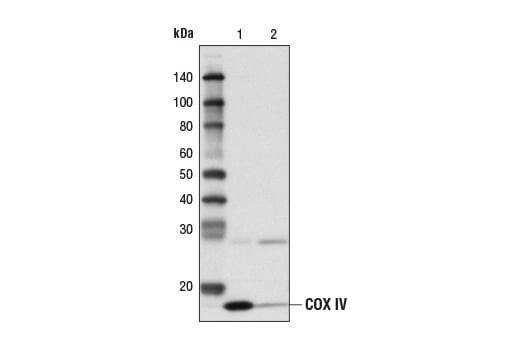 Immunoprecipitation Image 1: Protein G Agarose Beads