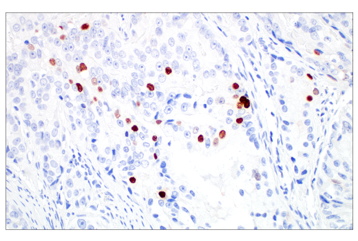 Immunohistochemistry Image 6: MAGE-C2/CT10 (E7B8D) XP<sup>®</sup> Rabbit mAb