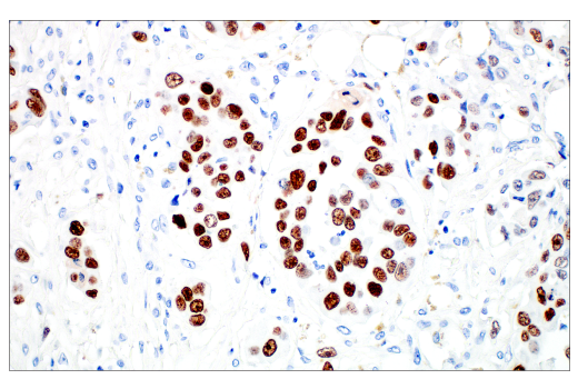 Immunohistochemistry Image 4: MAGE-C2/CT10 (E7B8D) XP<sup>®</sup> Rabbit mAb