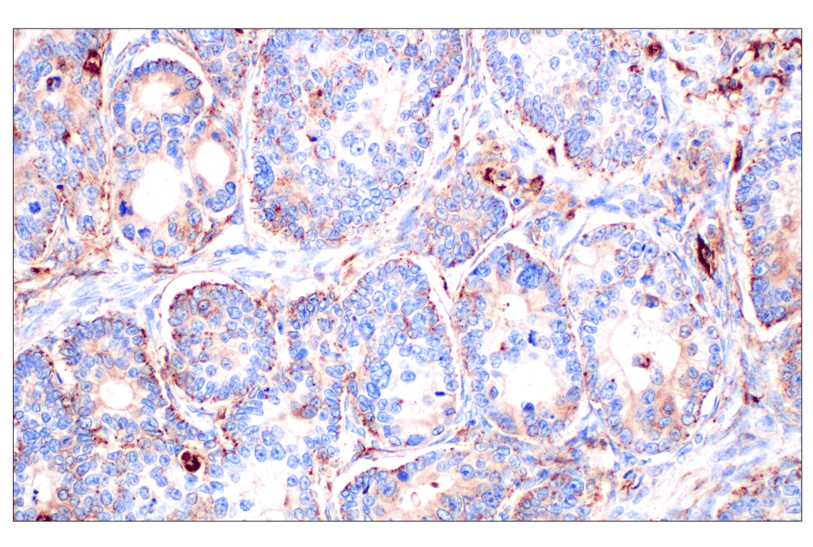 Immunohistochemistry Image 1: Cathepsin A (F8X9E) Rabbit mAb