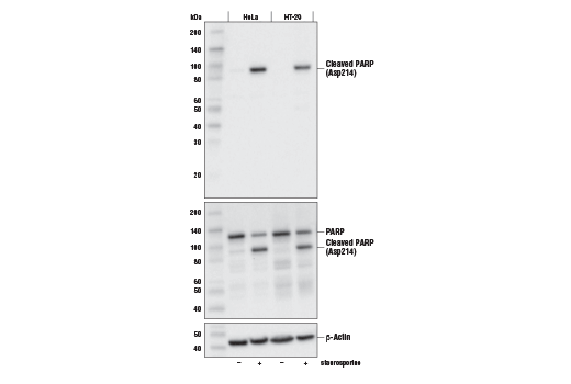 undefined Image 3: Apoptosis Antibody Sampler Kit II