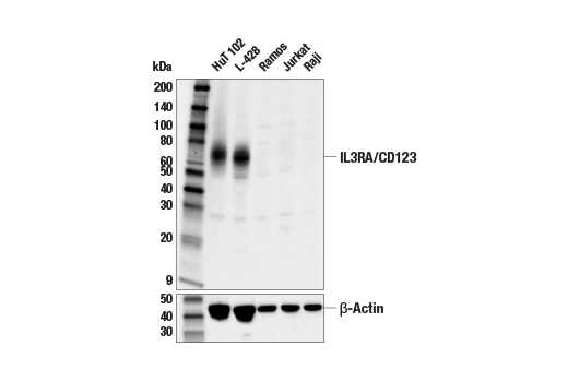 Western Blotting Image 1: IL3RA/CD123 (E8B3N) Rabbit mAb