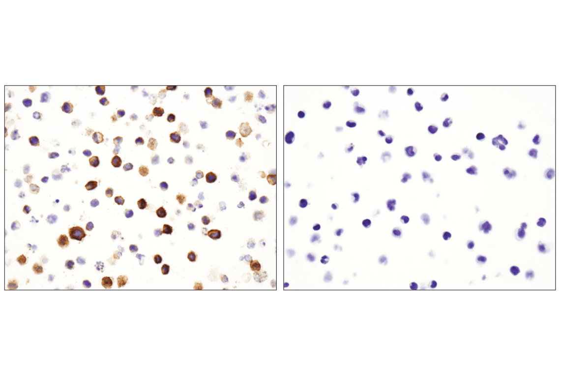 Immunohistochemistry Image 5: CD36 (D8L9T) Rabbit mAb (BSA and Azide Free)