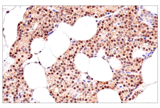 Immunohistochemistry Image 5: p70 S6 Kinase (E8K6T) XP<sup>®</sup> Rabbit mAb