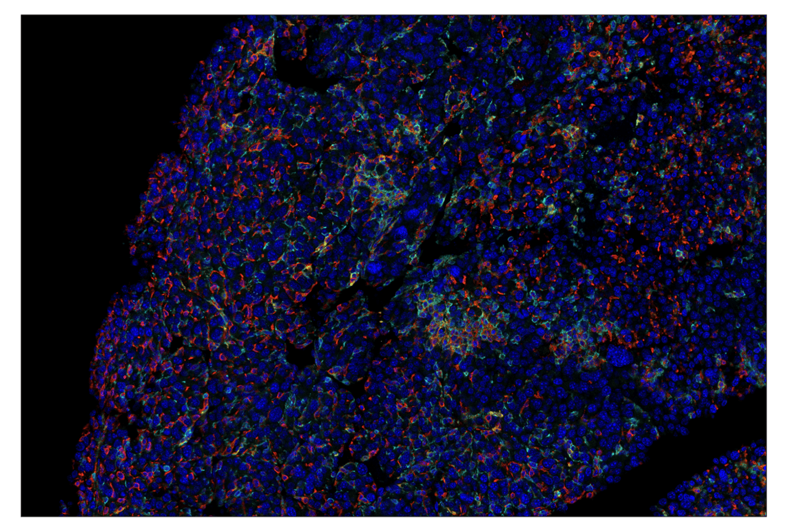 Immunohistochemistry Image 1: CD86 (E5W6H) & CO-0051-594 SignalStar<sup>™</sup> Oligo-Antibody Pair