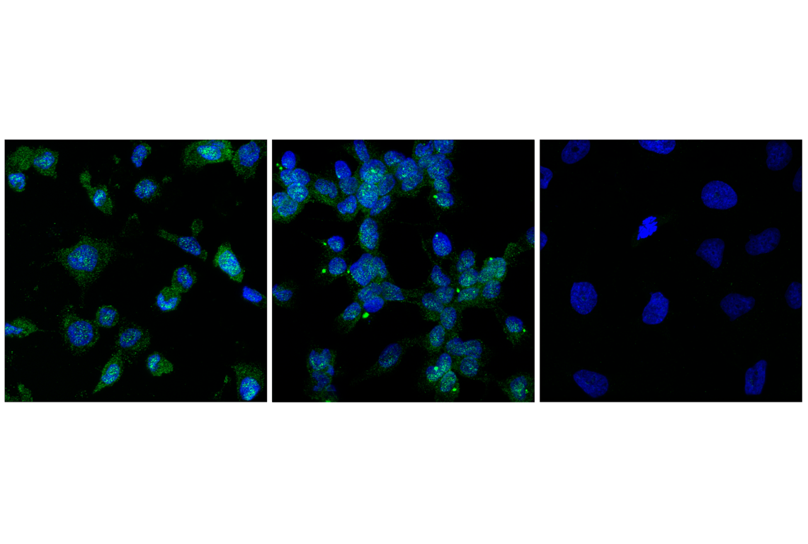 Immunofluorescence Image 1: ASC/TMS1 (F8U7P) Rabbit mAb