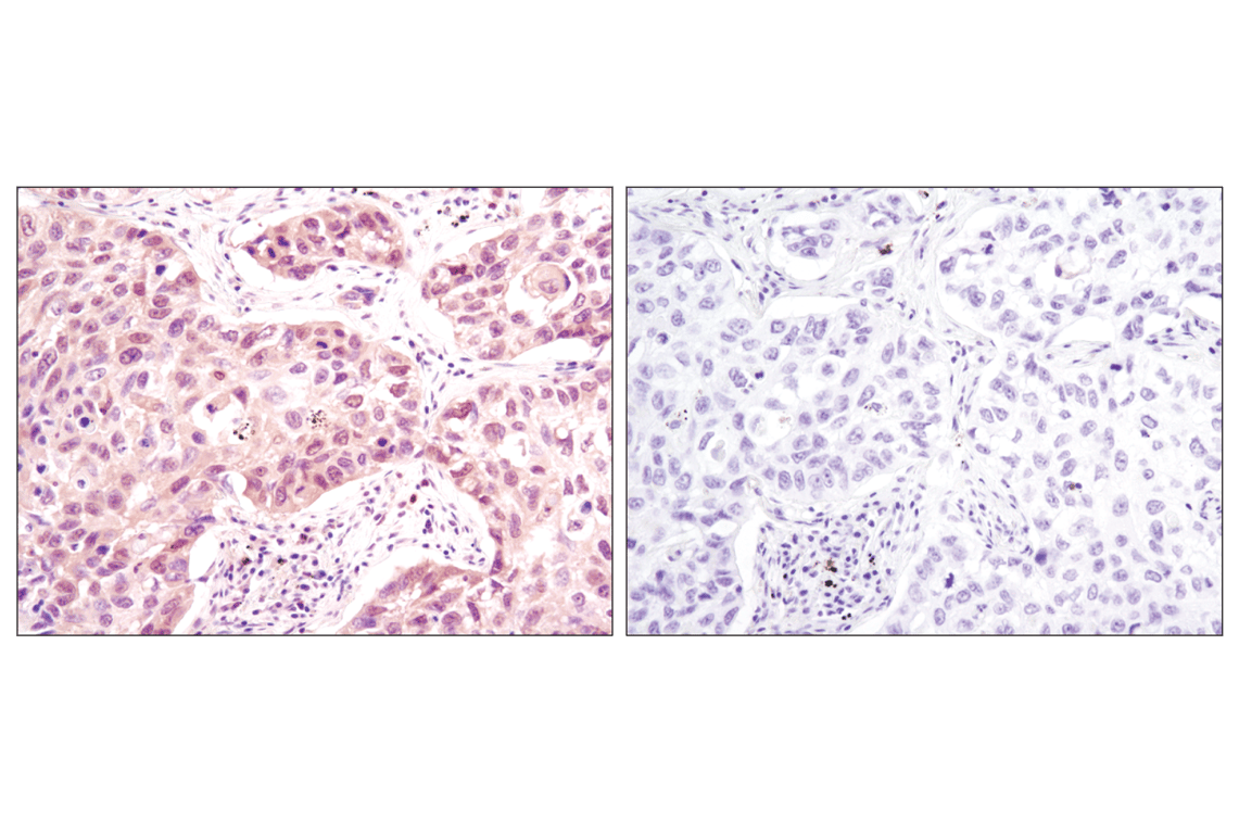 Immunohistochemistry Image 3: p38 MAPK (D13E1) XP<sup>®</sup> Rabbit mAb (BSA and Azide Free)