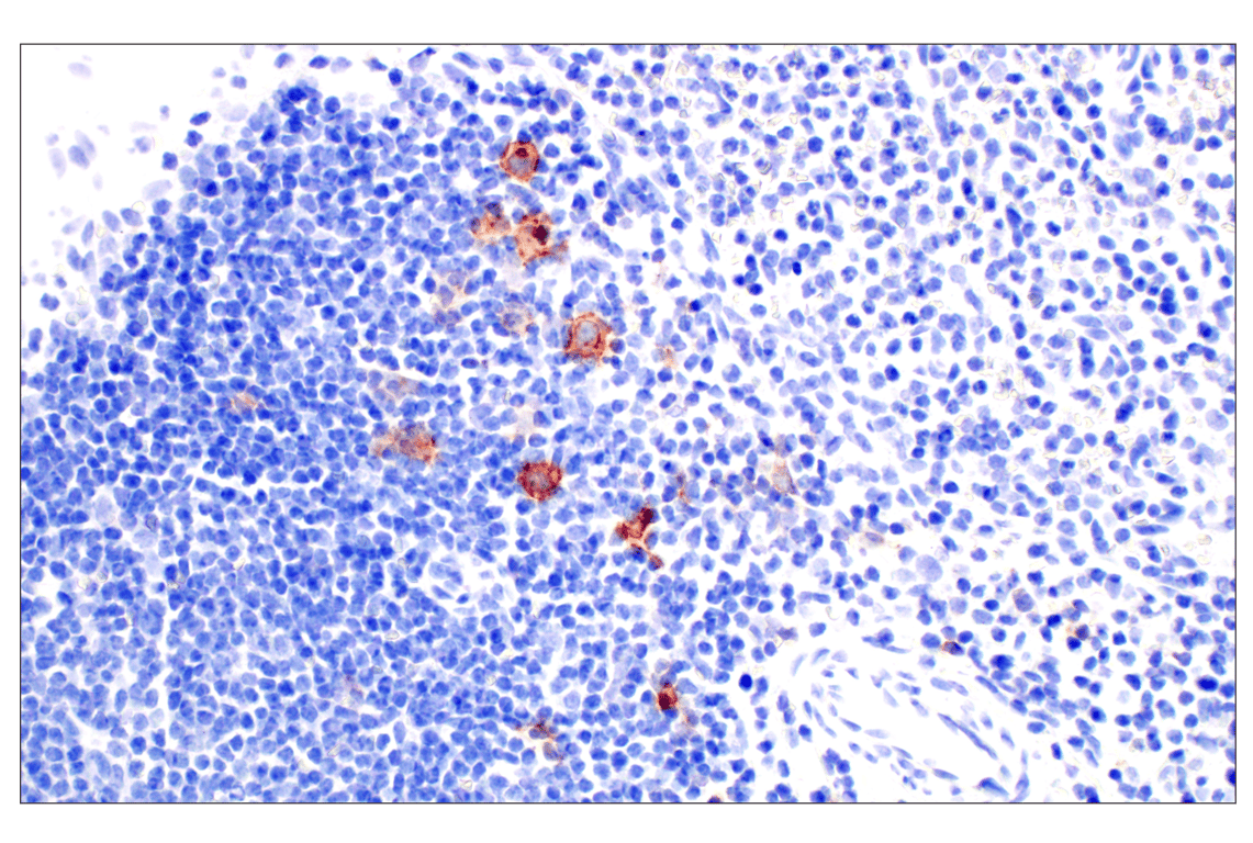 Immunohistochemistry Image 5: TNFRSF8/CD30 (E7E4D) XP<sup>®</sup> Rabbit mAb (BSA and Azide Free)