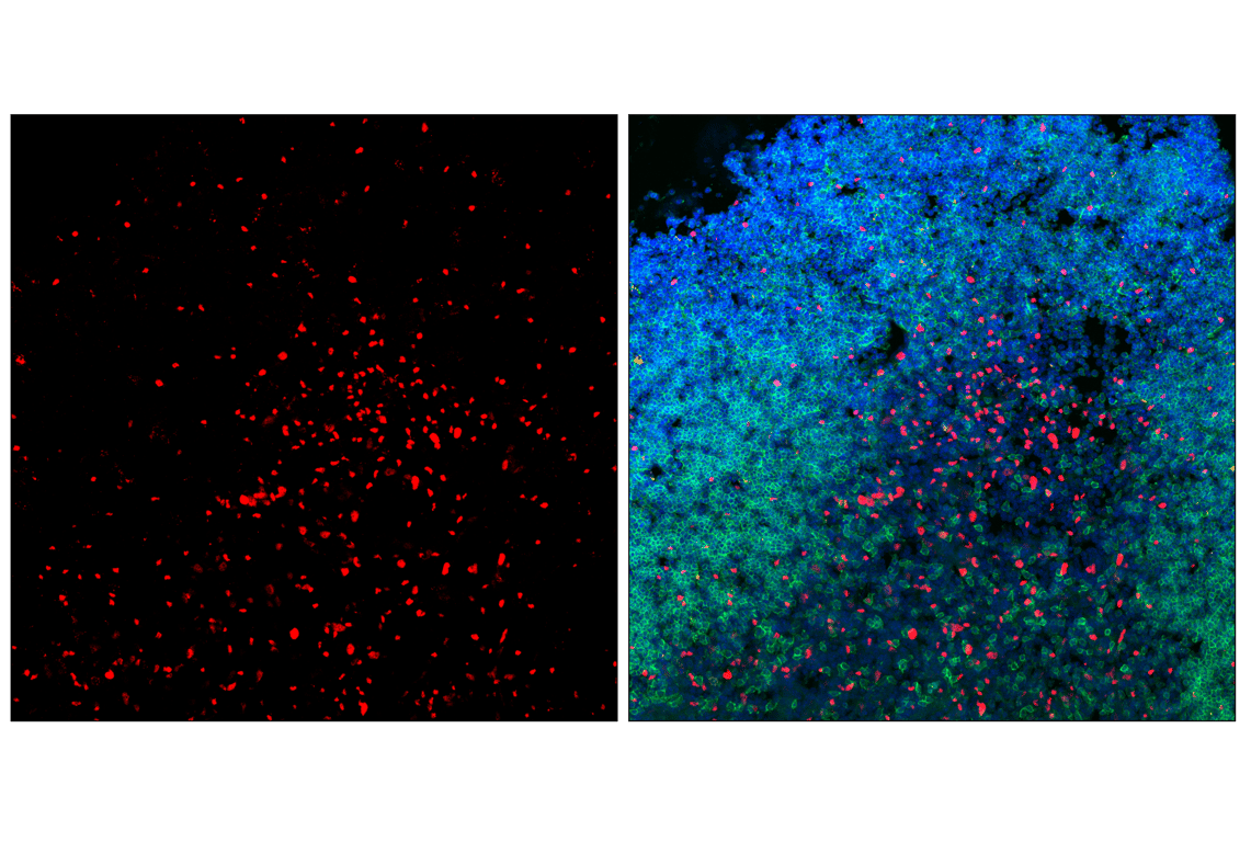 Immunofluorescence Image 1: T-bet/TBX21 (E4I2K) Rabbit mAb (Alexa Fluor<sup>®</sup> 647 Conjugate)