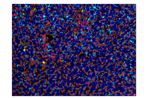 Immunohistochemistry Image 3: CD8α (D4W2Z) XP<sup>®</sup> Rabbit mAb (BSA and Azide Free)