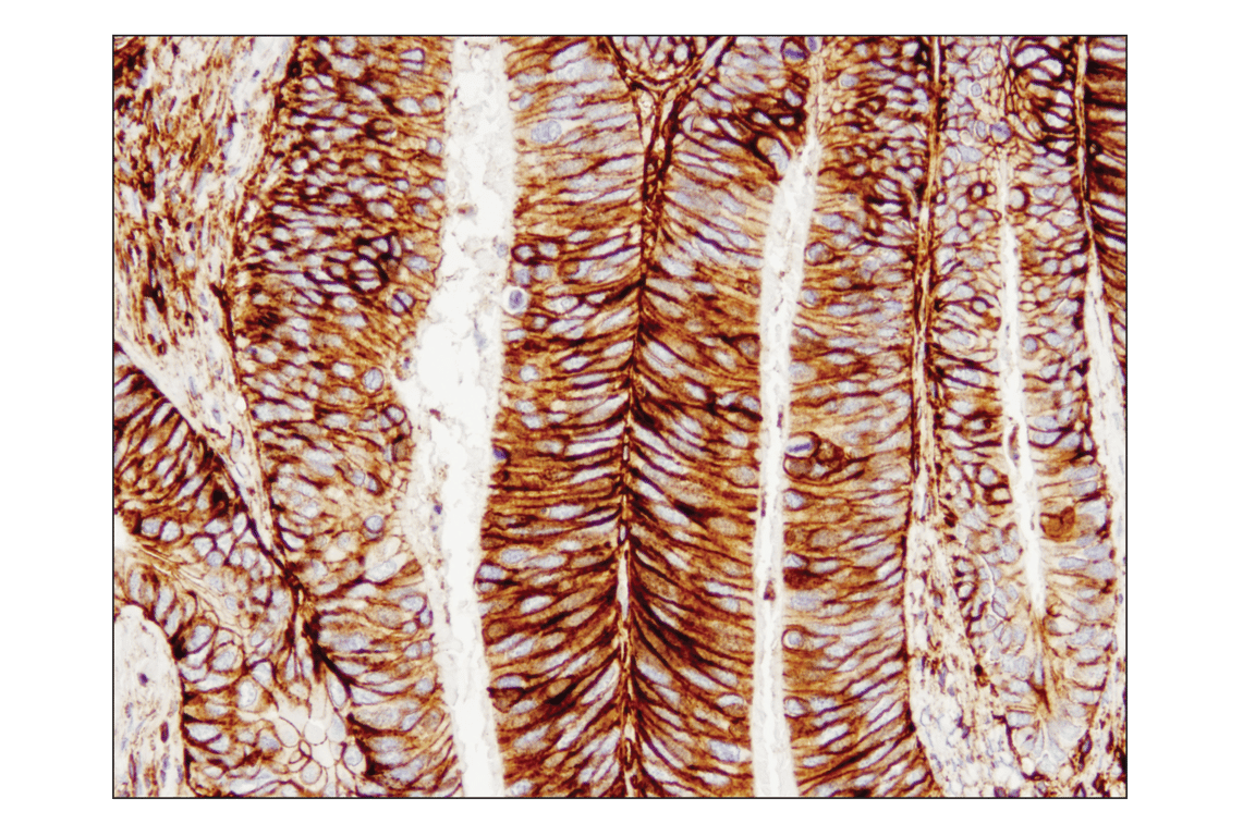 Immunohistochemistry Image 1: CD44 (E7K2Y) XP<sup>®</sup> Rabbit mAb (BSA and Azide Free)