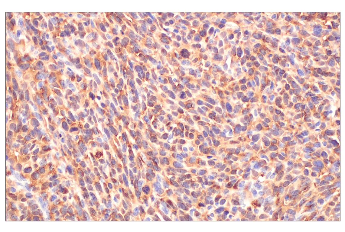 Immunohistochemistry Image 10: MTAP (E5R1I) Rabbit mAb (BSA and Azide Free)