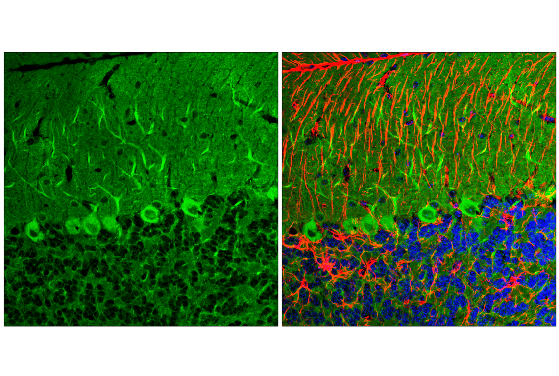 Immunofluorescence Image 1: LC3A/B (D3U4C) XP<sup>®</sup> Rabbit mAb (BSA and Azide Free)