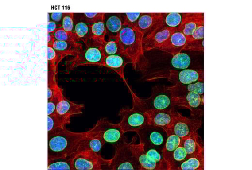 undefined Image 20: YAP/TAZ Transcriptional Targets Antibody Sampler Kit