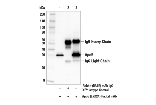 undefined Image 3: Late-Onset Alzheimer's Disease Risk Gene (Mouse Model) Antibody Sampler Kit