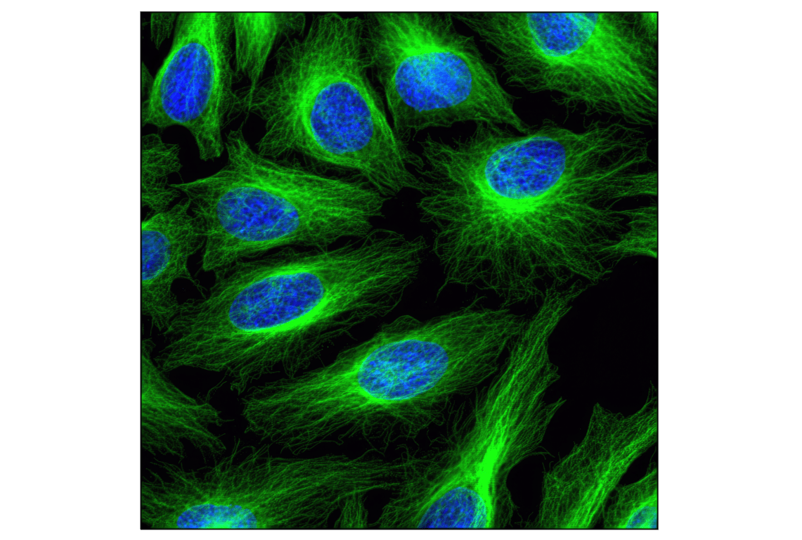 Immunofluorescence Image 1: β-Tubulin (9F3) Rabbit mAb
