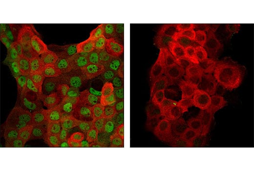 undefined Image 10: Stat3/Stat5 Signaling Antibody Sampler Kit