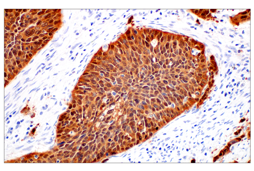 Immunohistochemistry Image 2: p16 INK4A (BC42) Mouse mAb
