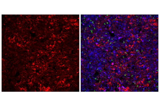 Immunofluorescence Image 2: STING (E9X7F) Rabbit mAb (Alexa Fluor<sup>®</sup> 647 Conjugate)