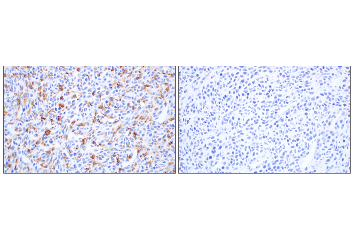 Immunohistochemistry Image 8: Siglec-1/CD169 (E1D7G) Rabbit mAb