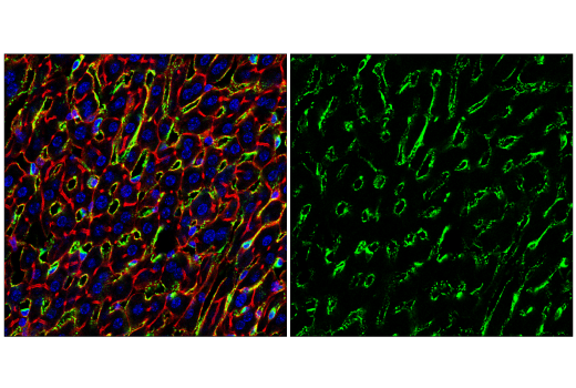 Immunofluorescence Image 2: CD206/MRC1 (E6T5J) XP<sup>®</sup> Rabbit mAb (BSA and Azide Free)