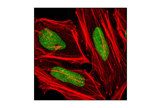 Immunofluorescence Image 1: PIAS1 (D33A7) XP<sup>®</sup> Rabbit mAb