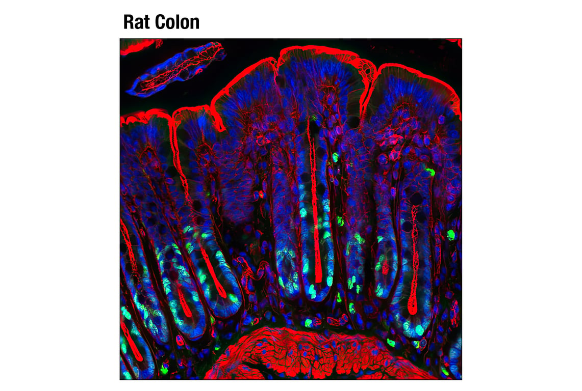 Immunofluorescence Image 1: Ki-67 (D3B5) Rabbit mAb (Alexa Fluor<sup>®</sup> 488 Conjugate)