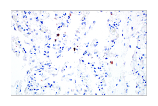 Immunohistochemistry Image 5: SARS-CoV-2 Nucleocapsid Protein (E8R1L) Mouse mAb