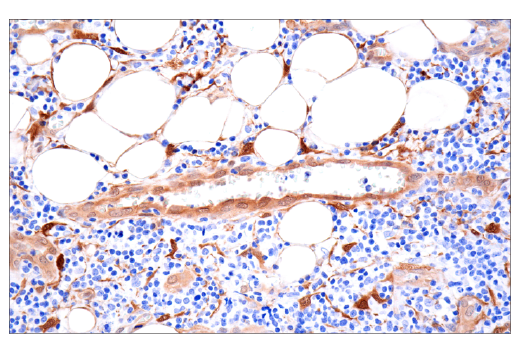 Immunohistochemistry Image 5: NNMT (E6N2Z) XP<sup>®</sup> Rabbit mAb