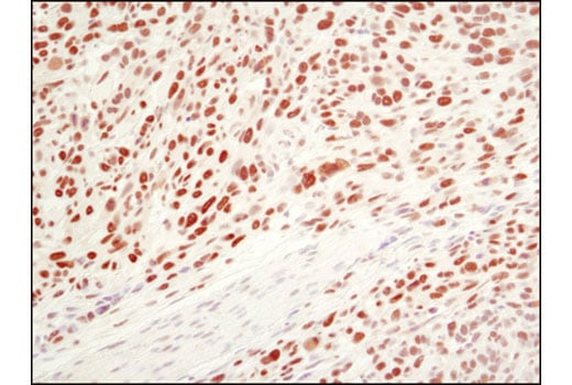 Immunohistochemistry Image 4: Ezh2 (D2C9) XP<sup>®</sup> Rabbit mAb (BSA and Azide Free)