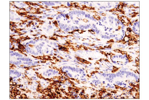 Immunohistochemistry Image 2: CD11c (D3V1E) XP<sup>®</sup> Rabbit mAb